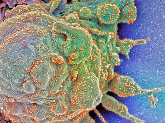 Grafika przedstawiająca ludzką komórkę atakowaną przez koronawirusa